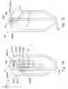 Fig. 43 - Disposable absorbent articles having multiple absorbent core components including replaceable components
