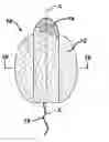 Fig. 01 - Method of using an intravaginal device with fluid transport plates