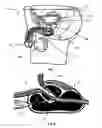Fig. 02 - Methods and devices for delivering therapeutic agents into the prostate gland