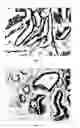 Fig. 11 - Methods and devices for delivering therapeutic agents into the prostate gland