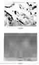 Fig. 12 - Methods and devices for delivering therapeutic agents into the prostate gland