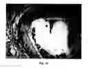 Fig. 13 - Methods and devices for delivering therapeutic agents into the prostate gland