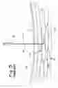 Fig. 06 - Surgical access apparatus and method