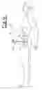 Fig. 07 - Surgical access apparatus and method