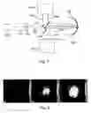 Fig. 02 - Real-time therapeutic dosimetry based on dynamic response of treated tissue