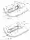 Fig. 02 - Method of positioning a medical instrument