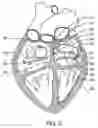 Fig. 05 - Method of positioning a medical instrument