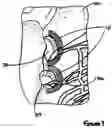 Fig. 02 - Electrosurgical device with discontinuous flow density