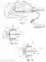 Fig. 02 - Surgical closure method and associated device