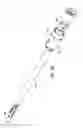 Fig. 28 - Endoscopic rotary abrader