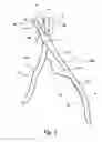 Fig. 02 - Hair trimmer