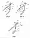 Fig. 05 - Hair trimmer
