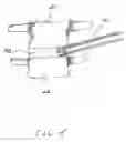 Fig. 16 - Expandable intervertebral disc dilating cannula