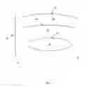 Fig. 02 - Device and method of weight control via indirect abdominal cavity volume reduction