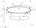 Fig. 01 - Device and method of weight control via indirect abdominal cavity volume reduction