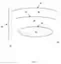 Fig. 02 - Device and method of weight control via indirect abdominal cavity volume reduction