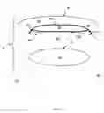Fig. 03 - Device and method of weight control via indirect abdominal cavity volume reduction