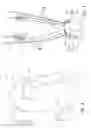 Fig. 03 - System to provide myocardial and neural stimulation