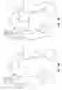 Fig. 08 - System to provide myocardial and neural stimulation
