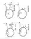 Fig. 63 - Method and system for cortical stimulation to provide adjunct (ADD-ON) therapy for stroke, tinnitus and other medical disorders using implantable and external components