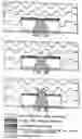 Fig. 04 - Stent having active release reservoirs