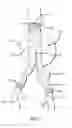Fig. 02 - Methods and Devices for Contributing to Improved Stent Graft Fixation and/or Seal