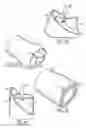 Fig. 03 - Heart valve and method for insertion of the heart valve into a bodily vessel