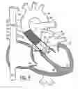 Fig. 10 - Heart valve and method for insertion of the heart valve into a bodily vessel