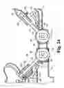Fig. 20 - Spinal device including lateral approach