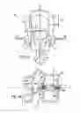 Fig. 02 - Method of anchoring an implant in an intervertebral disc