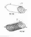 Fig. 43 - Method of anchoring an implant in an intervertebral disc