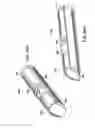 Fig. 72 - Method of anchoring an implant in an intervertebral disc