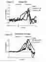 Fig. 07 - Prosthetic devices and methods and systems related thereto