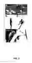 Fig. 03 - Gene silencing