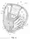 Fig. 06 - Baseball glove