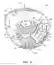 Fig. 07 - Baseball glove