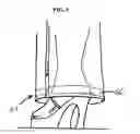 Fig. 06 - Pant leg stabilizer