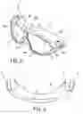 Fig. 04 - Swimming goggles