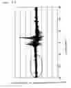 Fig. 12 - Combustion pressure sensor and glow plug including the same
