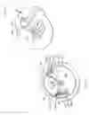 Fig. 04 - Electrostatic charge control for in-tank fuel module components