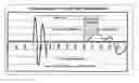 Fig. 01 - Methods for determining velocity of a stress wave within a material and homogeneity of properties within the material