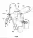 Fig. 06 - Attachment facilitating device for a bicycle