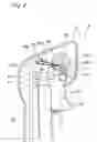 Fig. 09 - Operating apparatus of engine in portable working machine