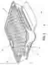 Fig. 02 - Inclusive single-use cooking apparatus