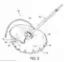Fig. 06 - Fireplace plug