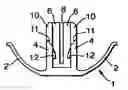Fig. 01 - Connecting clasp