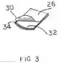 Fig. 04 - Distending nasal air filter