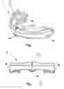 Fig. 02 - Oral appliance