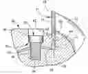 Fig. 01 - Rotary cutter head