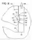 Fig. 05 - Rotary cutter head